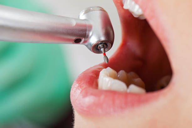 Best Broken Tooth Emergency  in Brentwood, CA